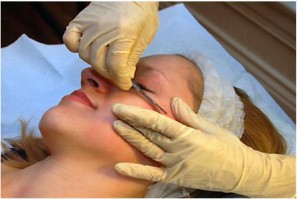 The dermaplaning process